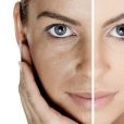 tips mejorar poros piel